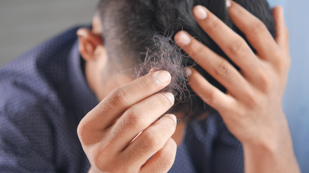 Hair fall problem in Young Adults