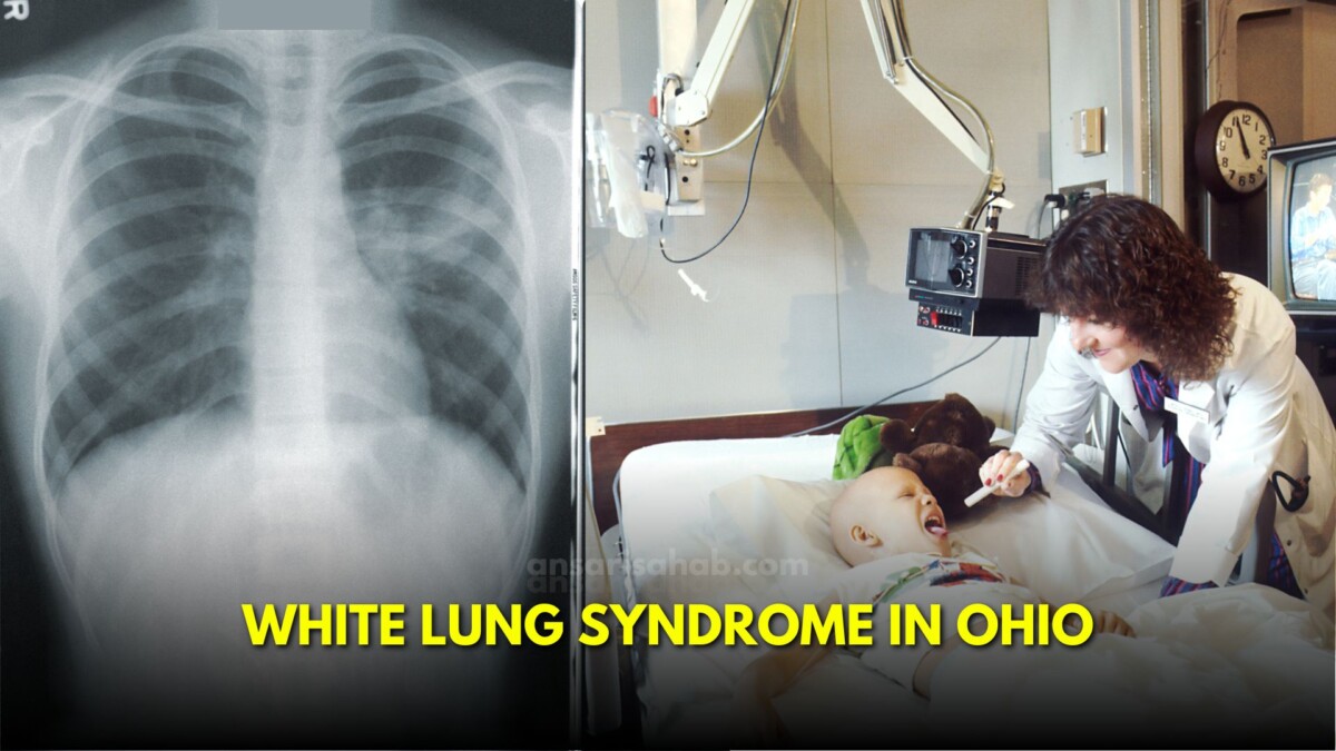 A Looming Threat in ohio "White Lung Syndrome" and the Rise of